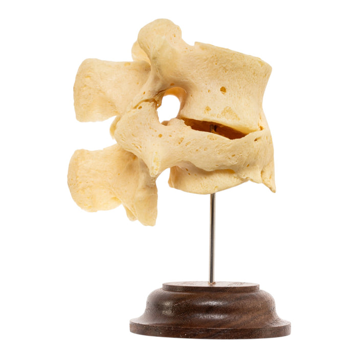 Real Human Lumbar Vertebrae - Fused