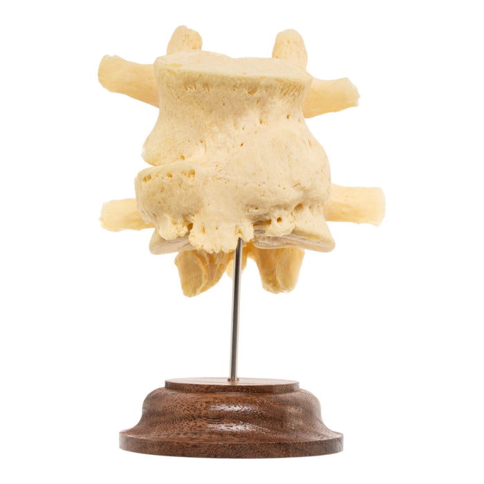 Real Human Lumbar Vertebrae - Fused
