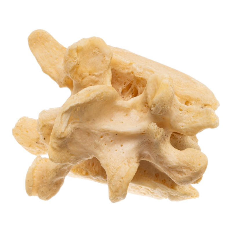 Real Human Lumbar Vertebrae - Fused