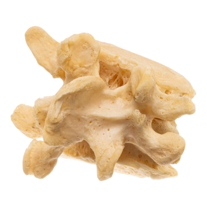 Real Human Lumbar Vertebrae - Fused