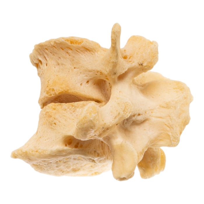 Real Human Lumbar Vertebrae - Fused