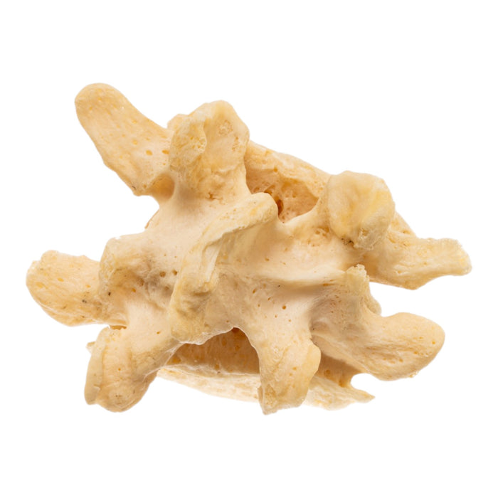 Real Human Lumbar Vertebrae - Fused