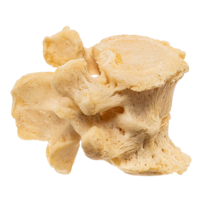 Real Human Lumbar Vertebrae - Fused