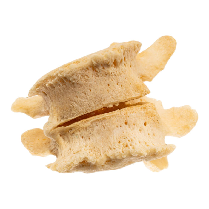 Real Human Lumbar Vertebrae - Fused