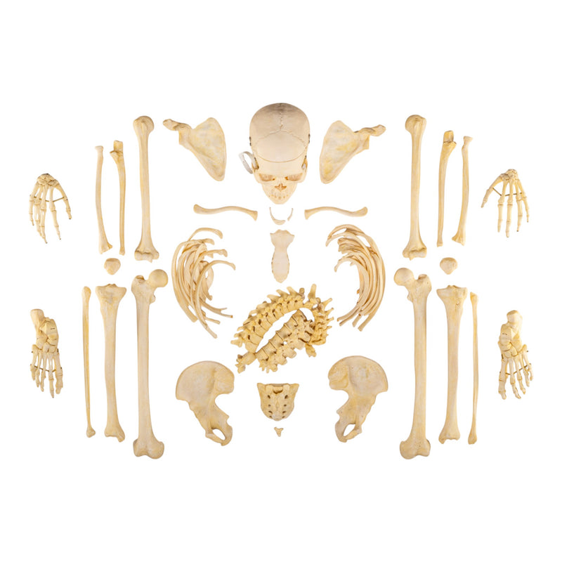 Real Human Skeleton - Disarticulated