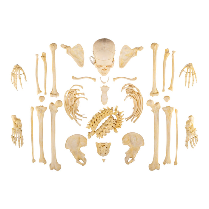 Real Human Skeleton - Disarticulated