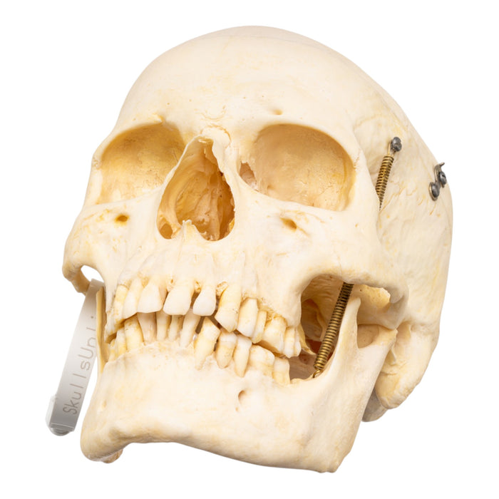 Real Human Skeleton - Disarticulated