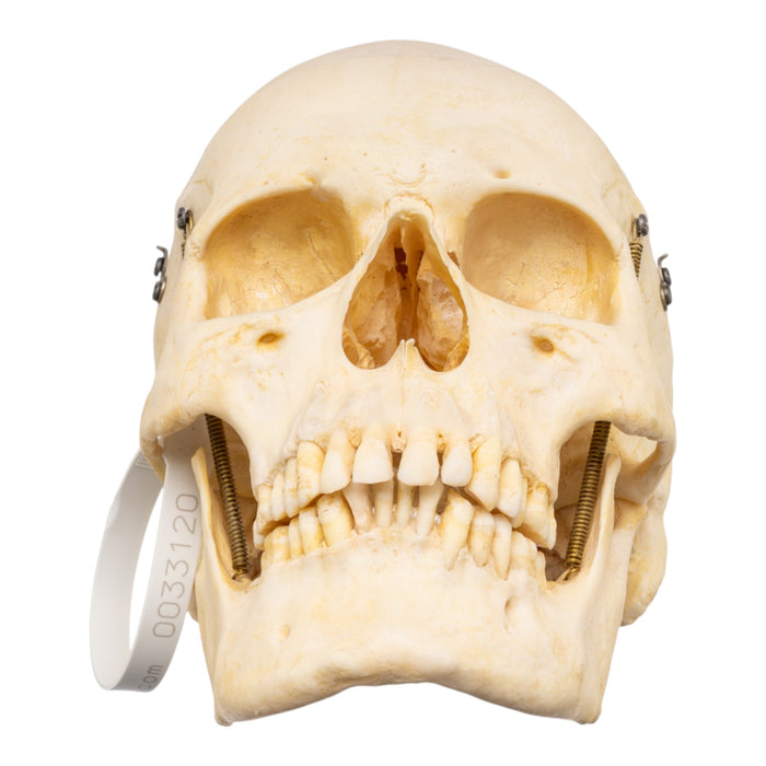 Real Human Skeleton - Disarticulated