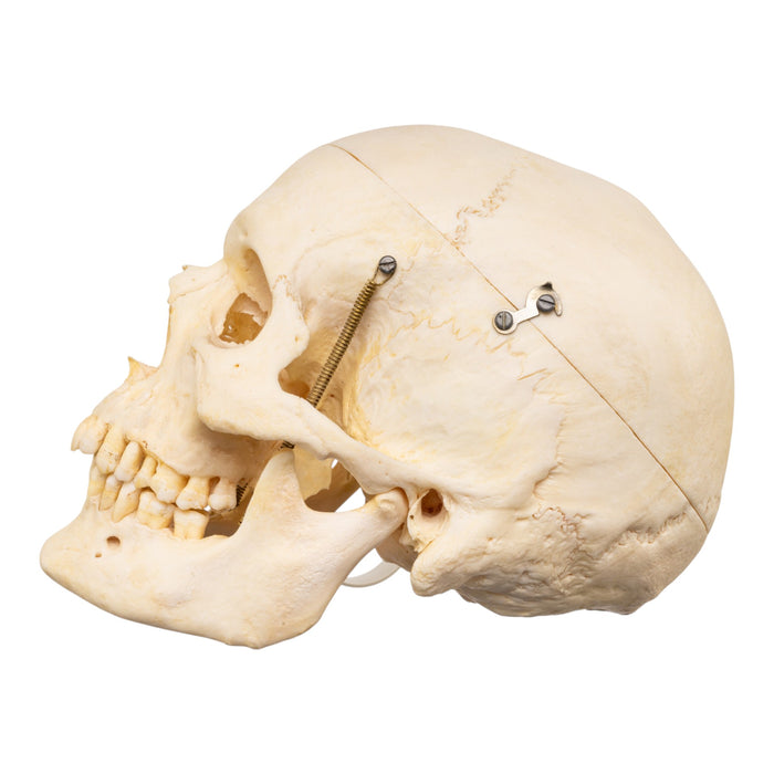 Real Human Skeleton - Disarticulated
