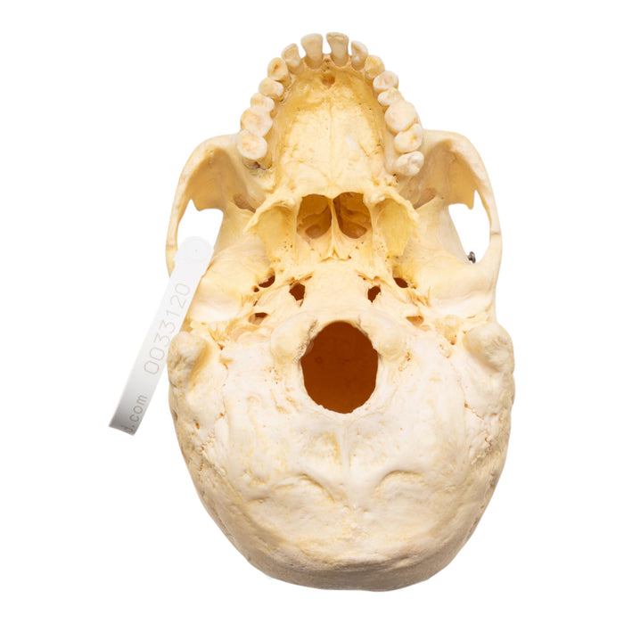 Real Human Skeleton - Disarticulated