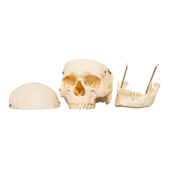 Real Human Skeleton - Disarticulated