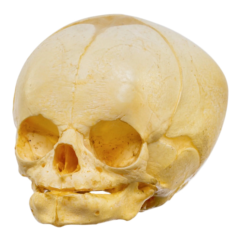 Real Human Fetal Skull