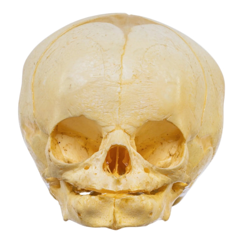 Real Human Fetal Skull