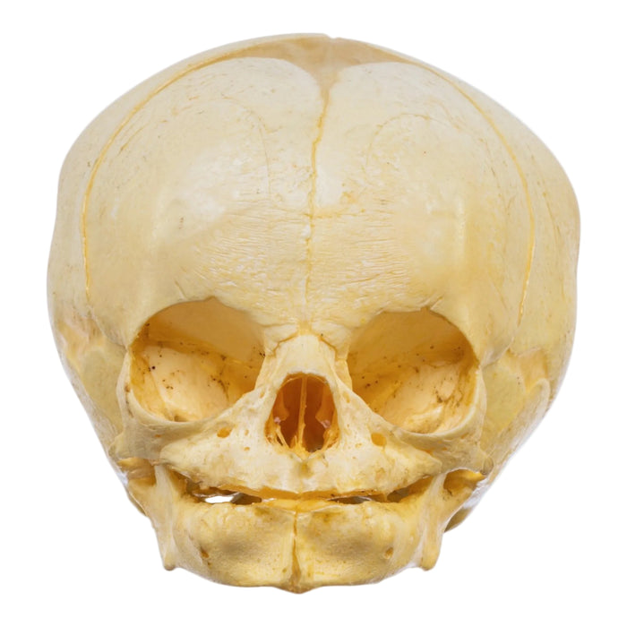 Real Human Fetal Skull