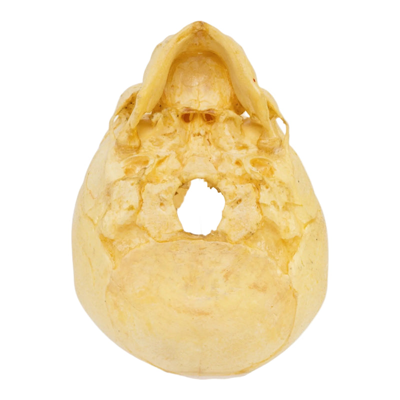 Real Human Fetal Skull