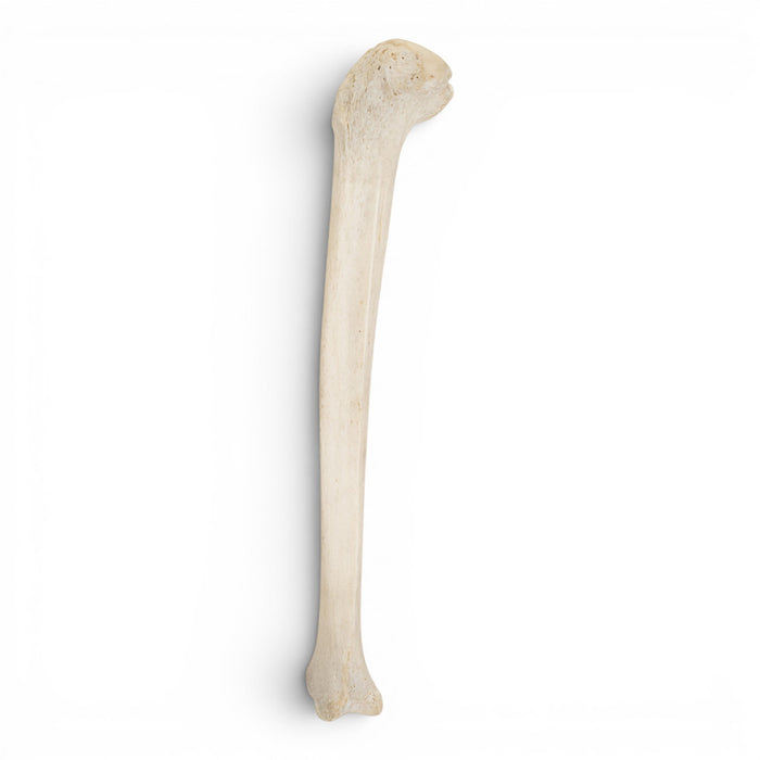 Real Human Tibia
