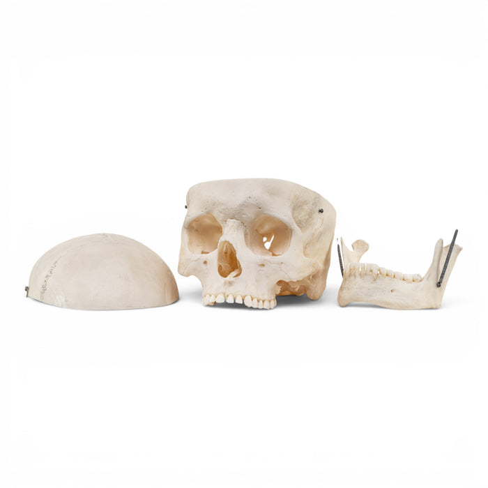 Real Human Skull