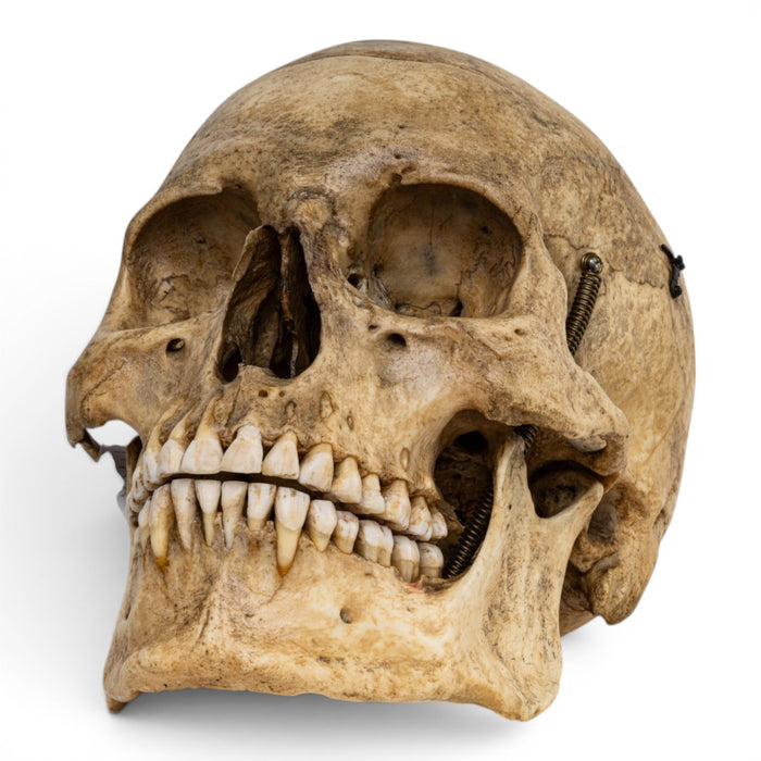 Real Human Skull