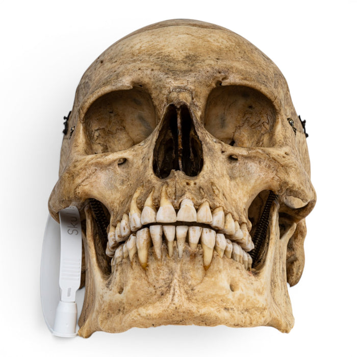 Real Human Skull