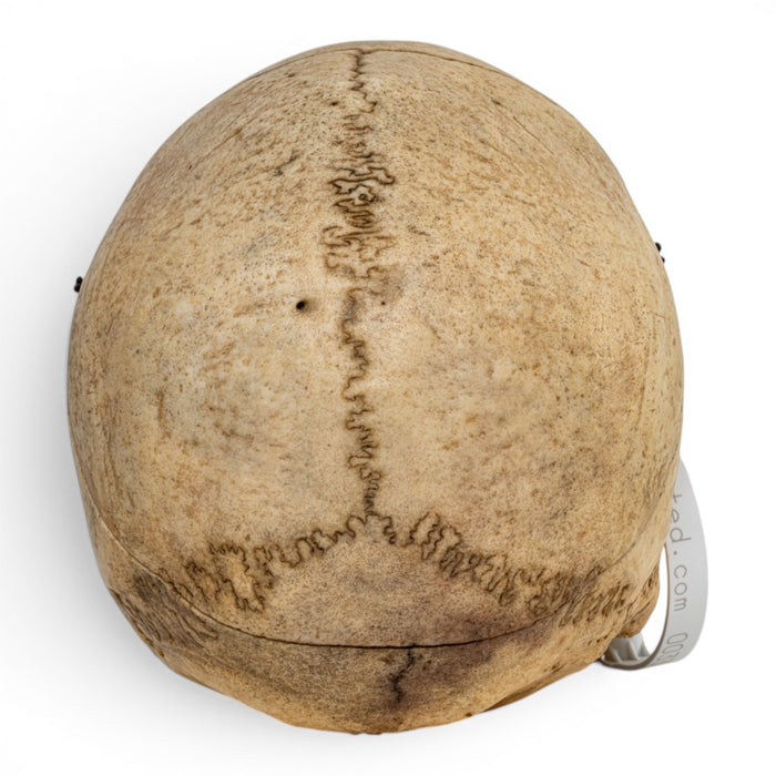 Real Human Skull