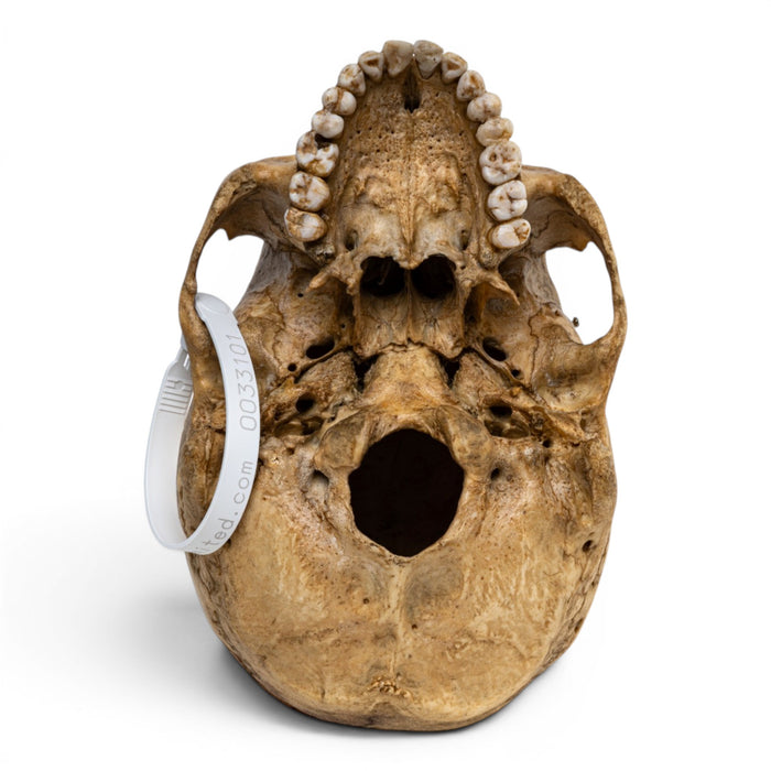 Real Human Skull