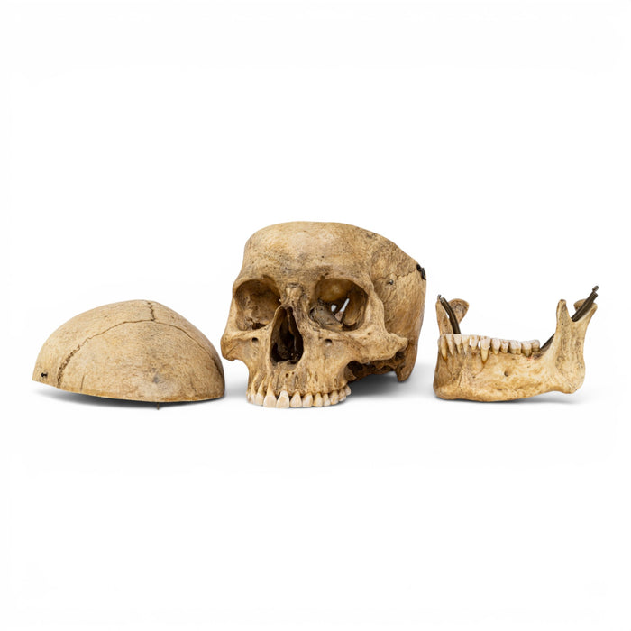 Real Human Skull