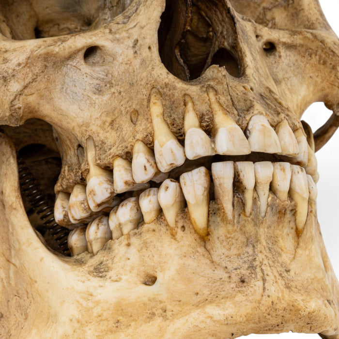 Real Human Skull