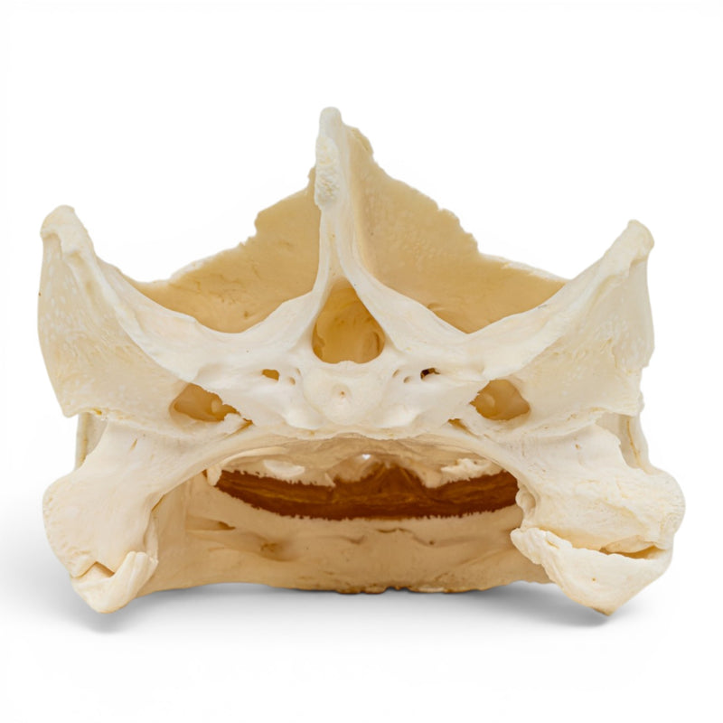Real Snapping Turtle Skull - Pathology