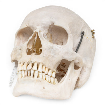 Real Human Skull