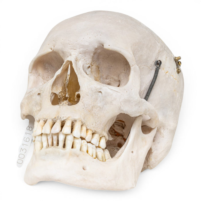 Real Human Skull