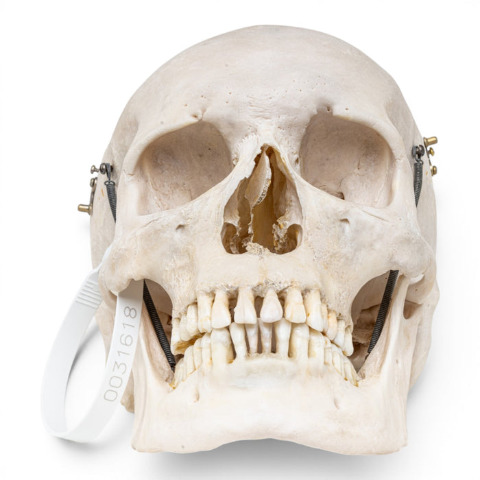 Real Human Skull