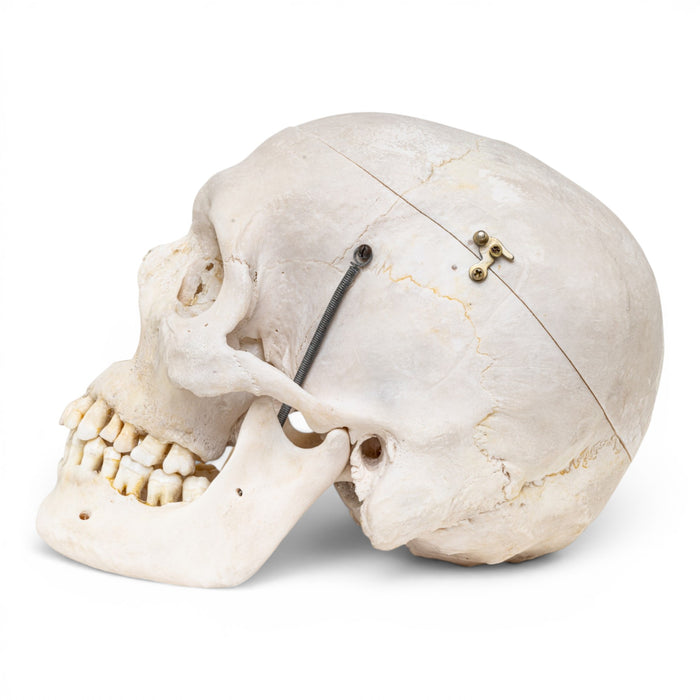 Real Human Skull