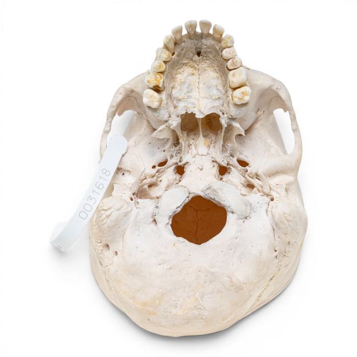 Real Human Skull