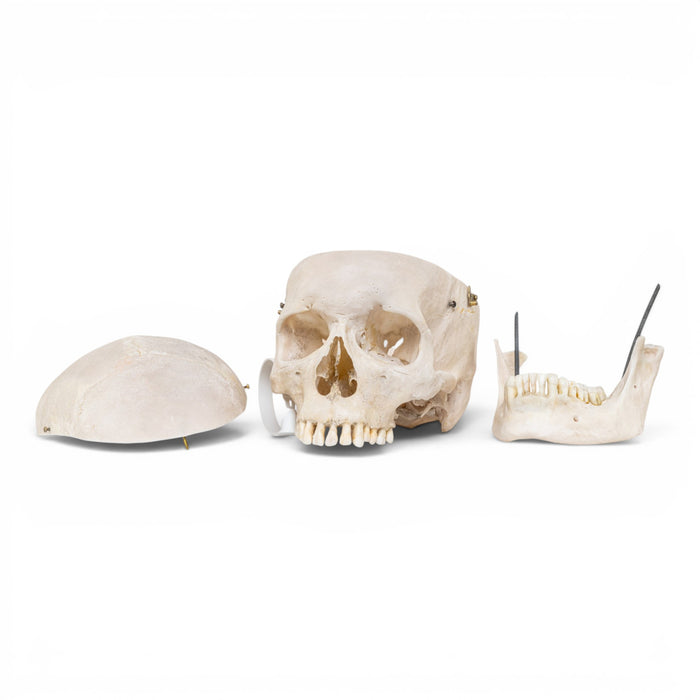 Real Human Skull