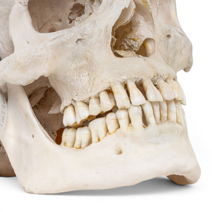 Real Human Skull
