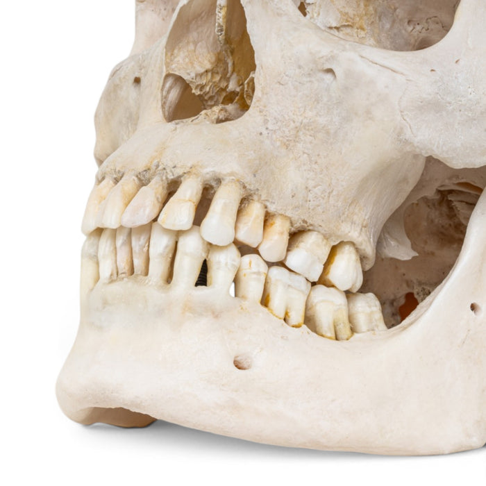 Real Human Skull