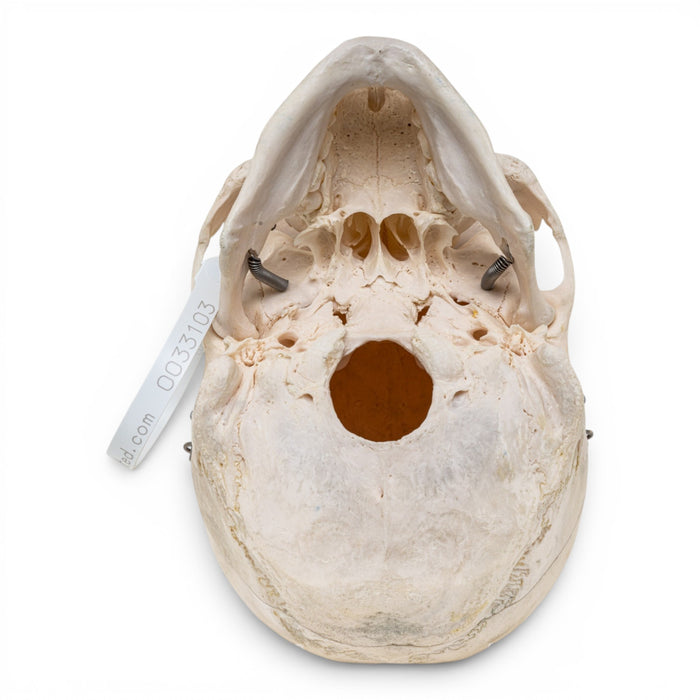 Real Human Skull