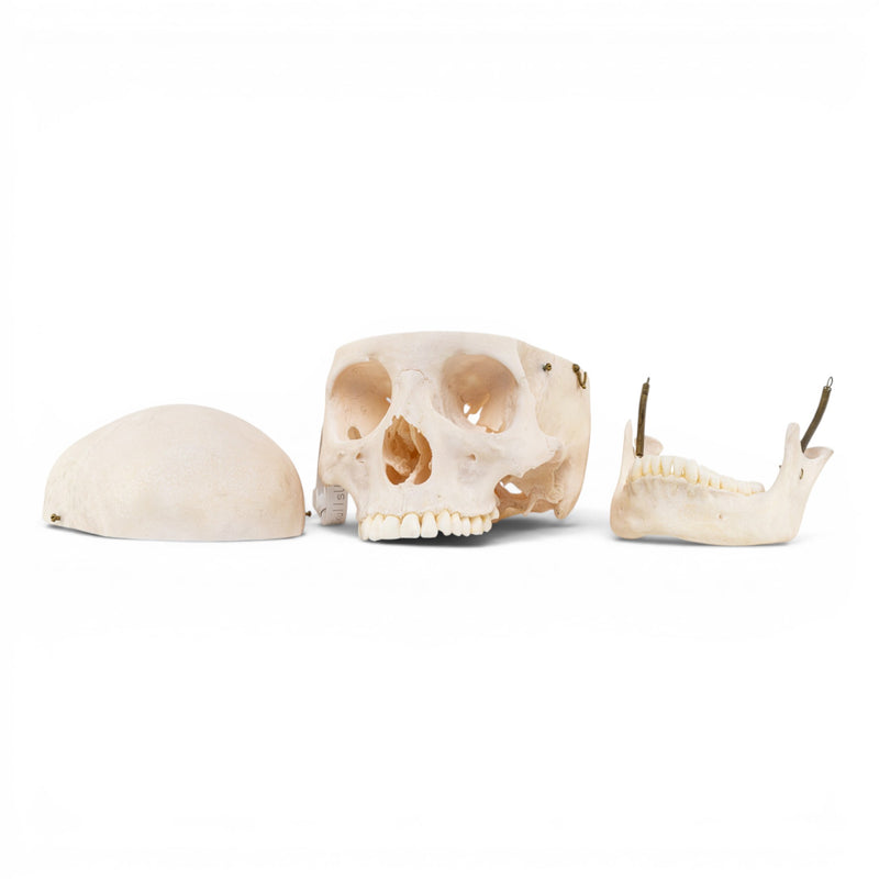 Real Human Skull