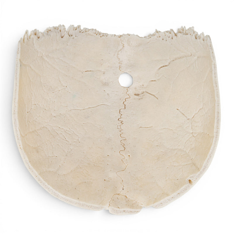 Real Human Partial Calvaria