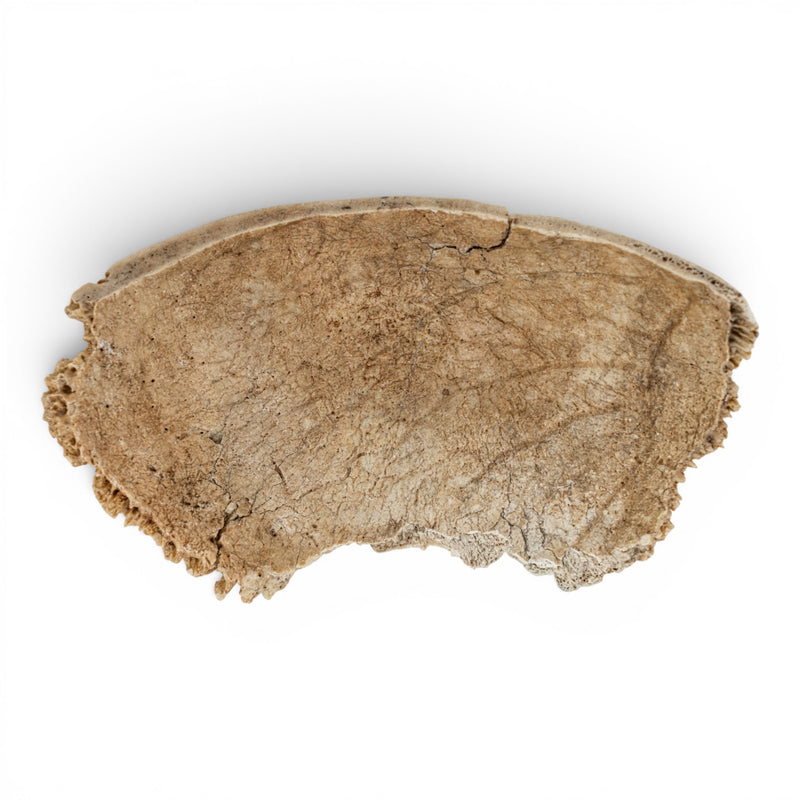 Real Human Partial Calvaria