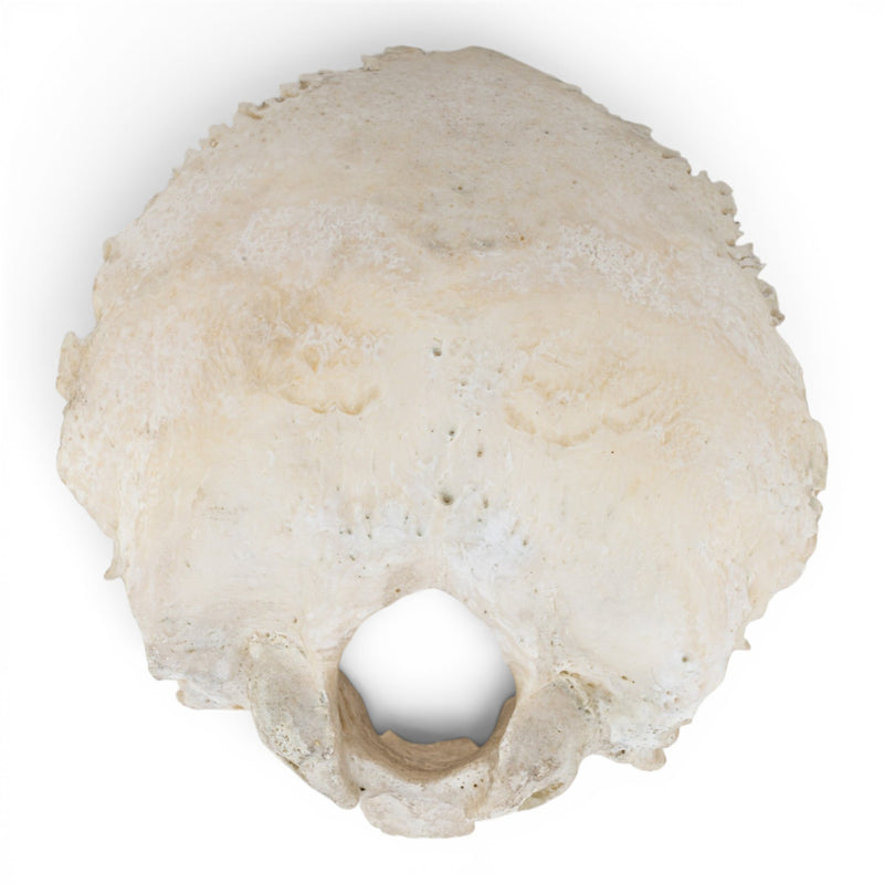 Real Human Occipital Bone