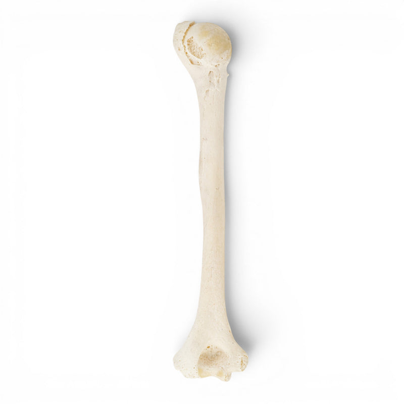 Real Human Humerus - Pathology