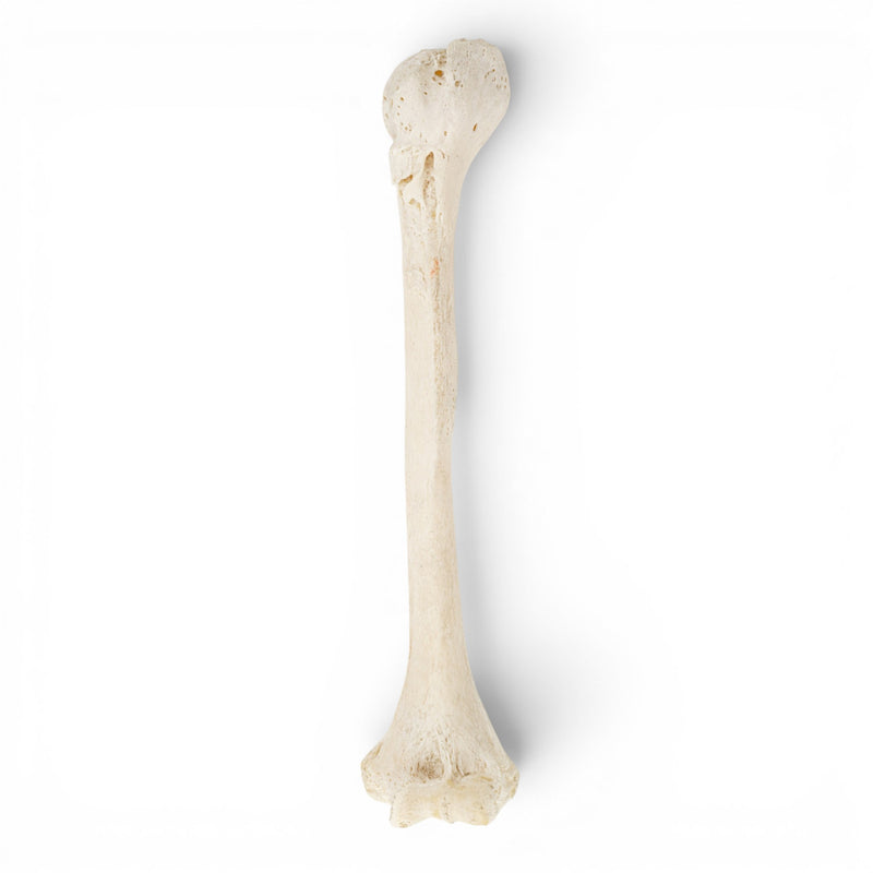Real Human Humerus - Pathology