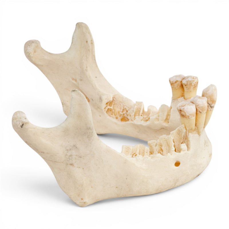 Real Human Mandible - Impaired