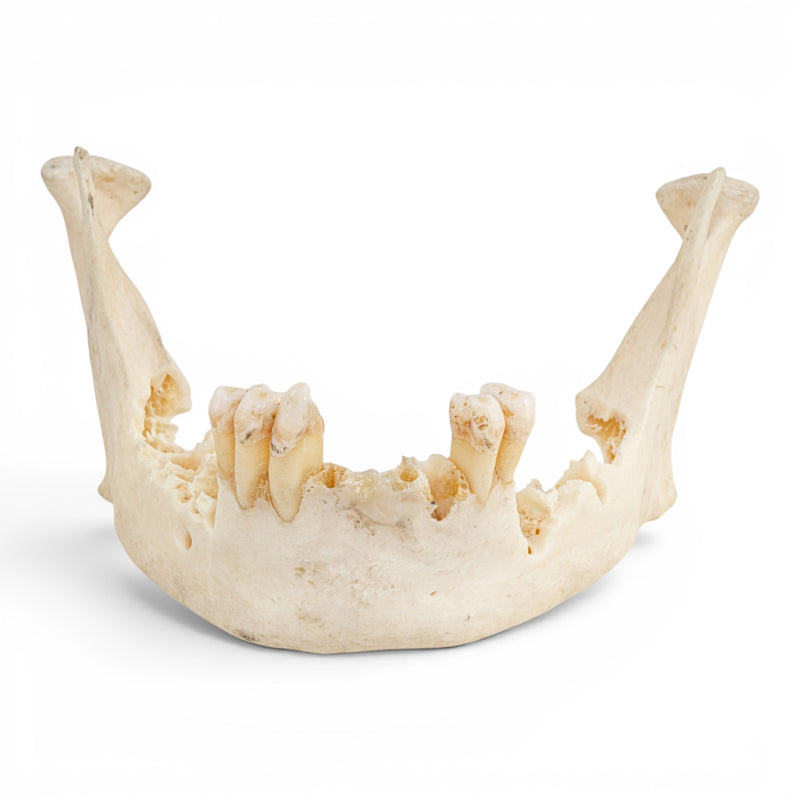 Real Human Mandible - Impaired