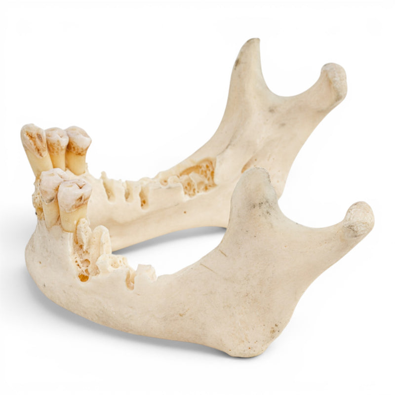 Real Human Mandible - Impaired
