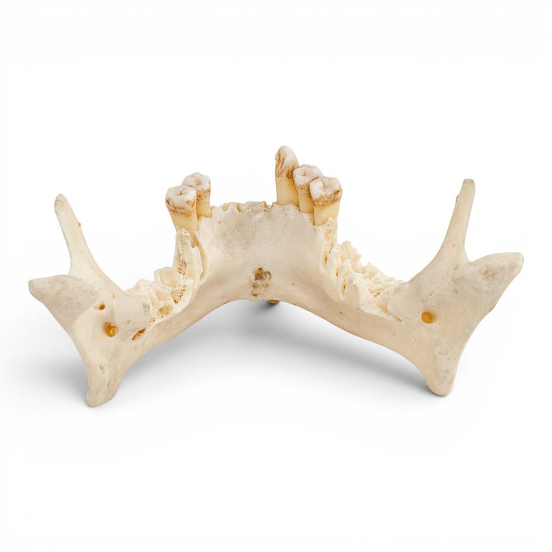 Real Human Mandible - Impaired
