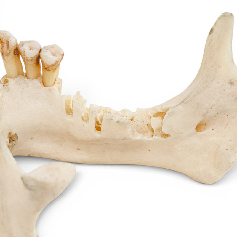 Real Human Mandible - Impaired