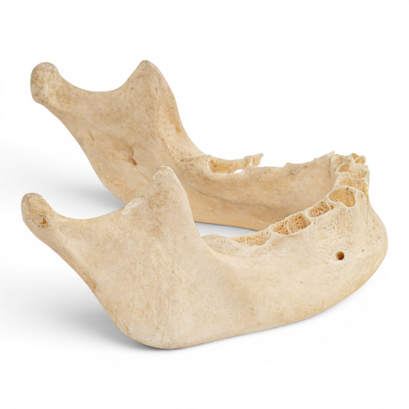 Real Human Mandible - Dissected