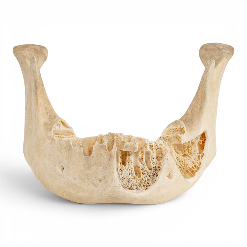 Real Human Mandible - Dissected
